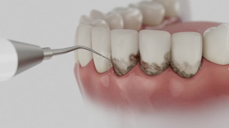 Reliable Dental contractor in Fenton, MI by Dentist Open Now